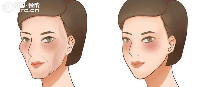 想要面部線條更清晰，又想保留脂肪顯飽滿？這道抗衰“命題”怎么