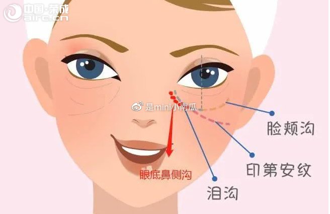 教你解決顯老印第安紋，拒絕“塌臉”式顏值翻車~