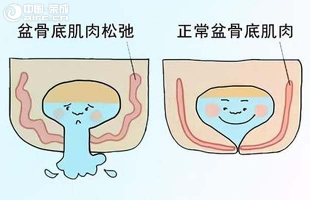  a(chn)ꎵɳڣһ©Ҫo