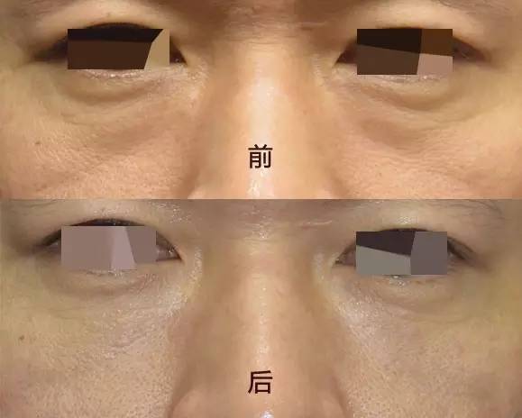 sɌO | ĘǂPQ߀۴Լ]cx(sh)