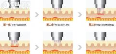 ʲôSl΢##